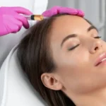 The Best Hair Loss Treatments and Lifestyle Changes to Try