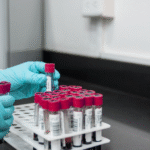 Why Batch Variation Ruins Comparability, and What Buyers Can Do