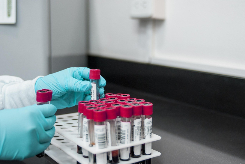 Why Batch Variation Ruins Comparability, and What Buyers Can Do